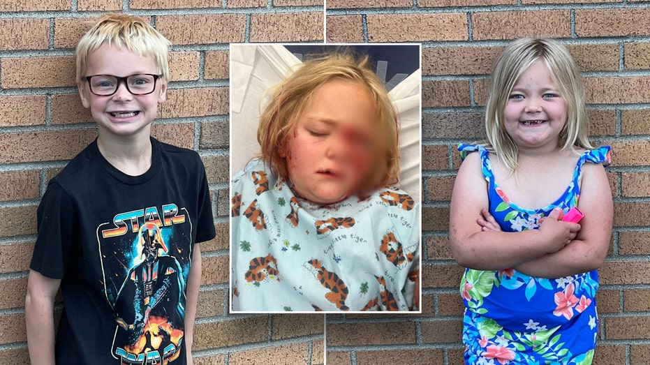 Michigan boy, 8, saves sister, 6, from near-fatal dog attack thumbnail