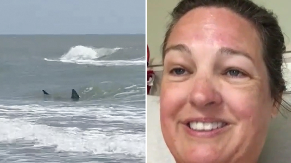 Texas South Padre Island shark attack survivor says her leg is ‘pretty much gone’