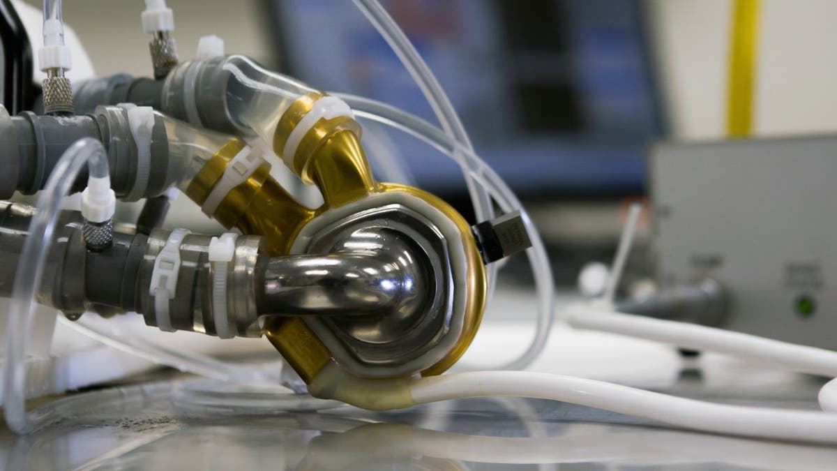 Mechanical artificial heart is using high-speed rail technology to keep patients alive