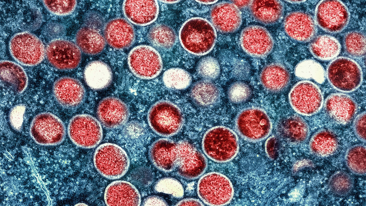 Color transmission electron micrograph of monkeypox particles