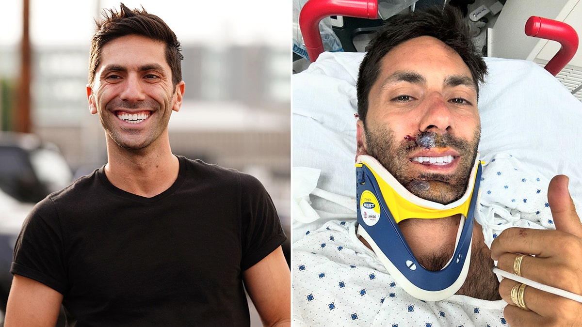 side by side photos of Nev Schulman and Nev Schulman in the hospital with a neckbrace.