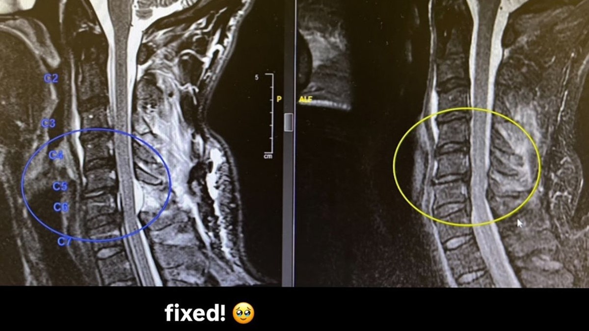 Nev Schulman's x-ray