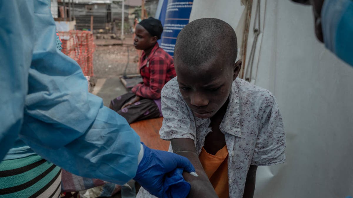 Blood sample mpox