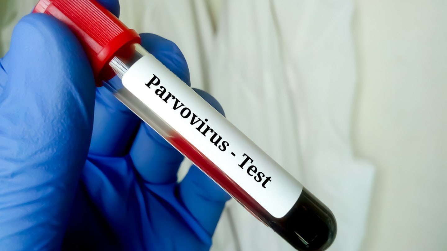 parvovirus test