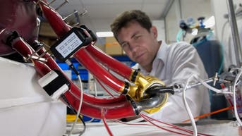 Mechanical artificial heart is using high-speed rail tech to keep patients alive - Fox News