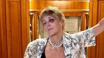 Sharon Stone reveals how she got ‘good-looking shiner’ on European trip - Fox News