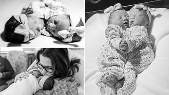 Atlanta couple’s conjoined twin daughters, fused at the heart, lived for just 1 hour: ‘Gift from God’