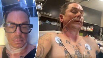 Slipknot's Sid Wilson Suffers Severe Burns in Fire Explosion