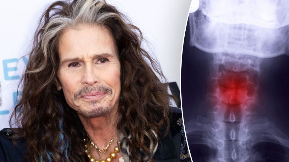 Steven Tyler’s career-ending throat injury: How dangerous is a fractured larynx?