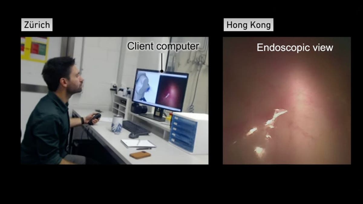 Los cirujanos utilizan el mando de la PlayStation para realizar endoscopias a larga distancia