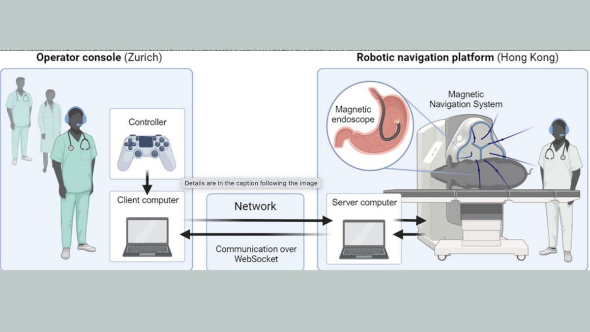 Surgeons use PlayStation controller for long-distance endoscopy