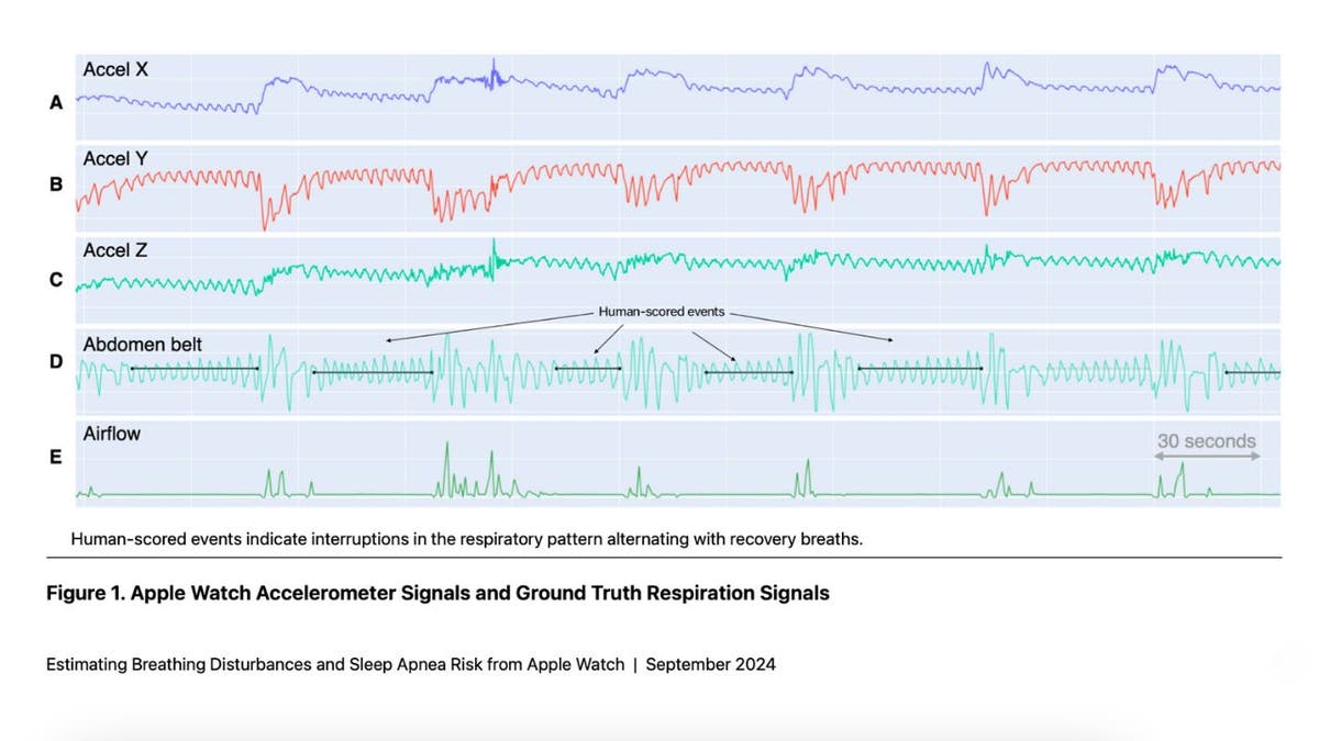 apple apnea del sueño 5