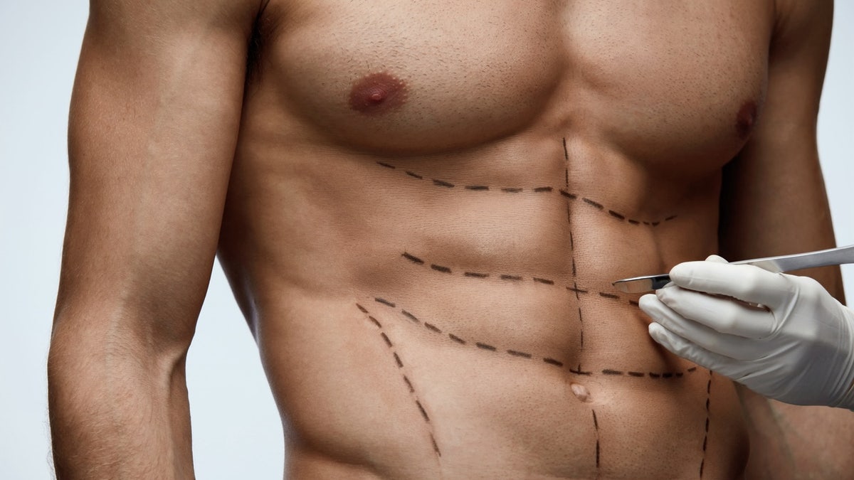 ‘Six-pack surgical procedure’ rising in popularity amongst males, say plastic surgeons