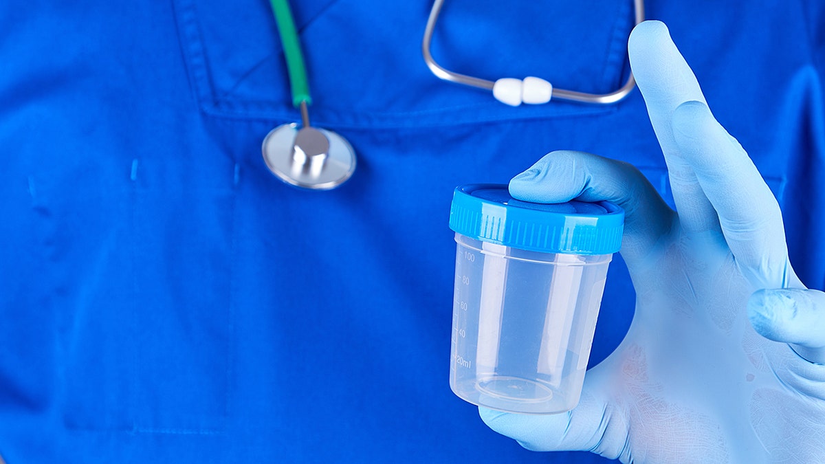 médico con guantes de látex sujetando un recipiente de plástico vacío para tomar muestras de orina