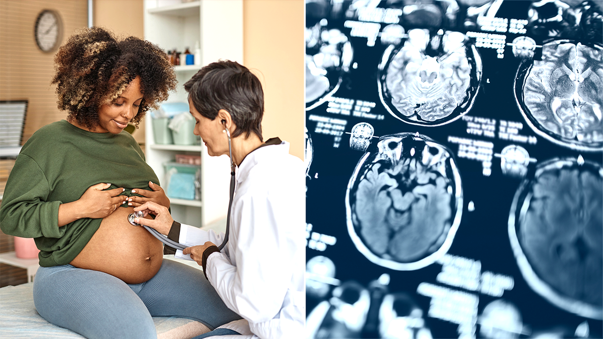 mujer embarazada en el médico junto a una imagen de escáner cerebral