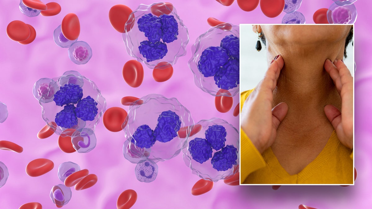 Lymphoma blood cells in background with woman touching neck