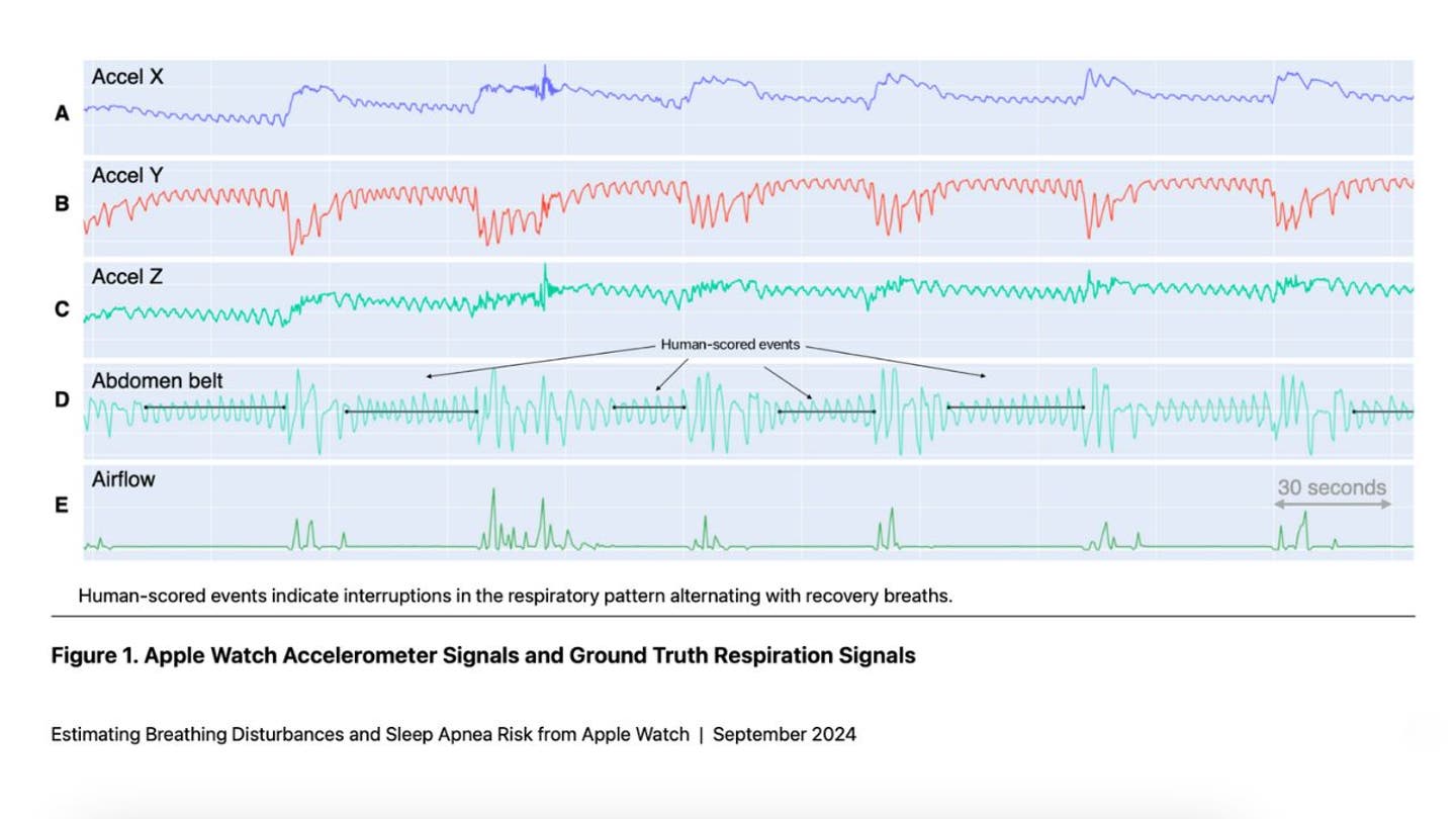 5 The Apple Watch could help you uncover hidden sleep apnea