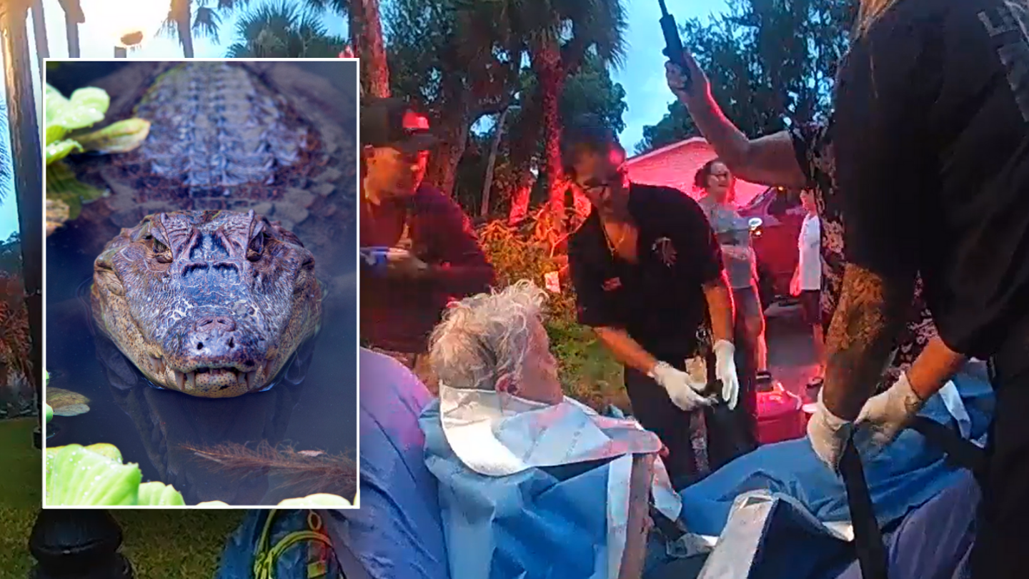 Fearless 84-Year-Old Florida Woman Punches Alligator in Face to Save Her Life