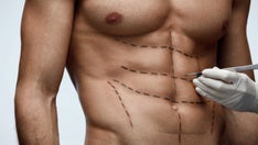 'Six-pack surgery' gaining popularity among men, say plastic surgeons