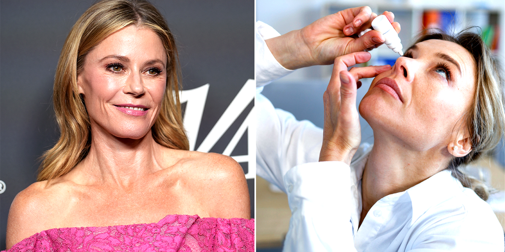 Julie Bowen of 'Modern Family' gets real about chronic dry eye: What to  know about the progressive condition