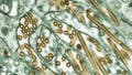 Colorized transmission electron micrograph of Avian influenza A H5N1 viruses (seen in gold) grown in MDCK cells (seen in green). - Fox News