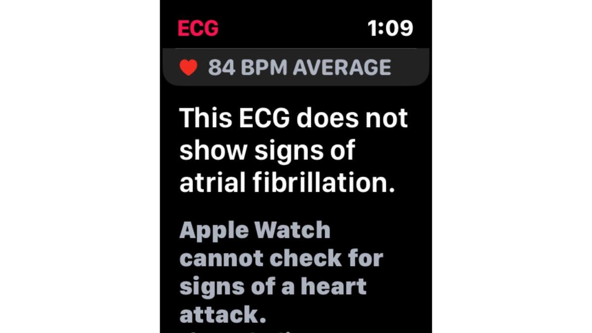 aplicación de electrocardiograma 7