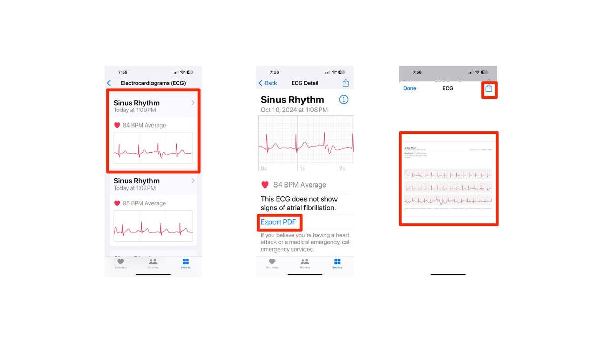 aplicación de electrocardiograma 9