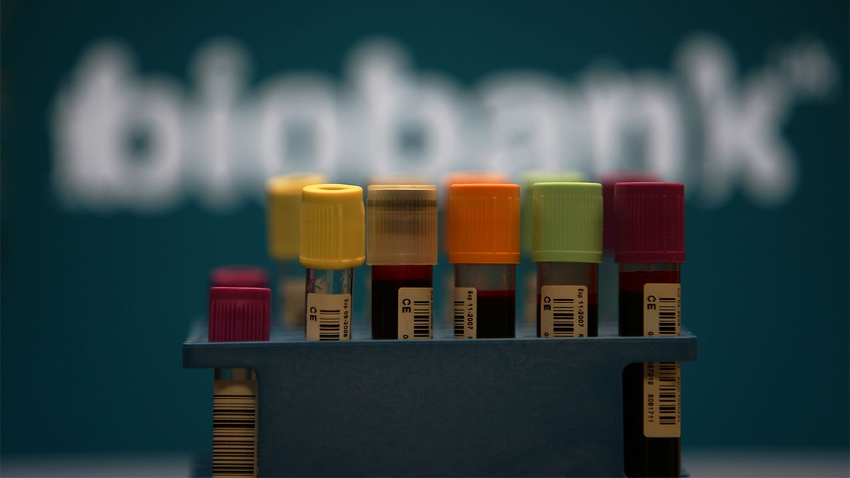 Bloedmonsters gedoneerd aan UK Biobank