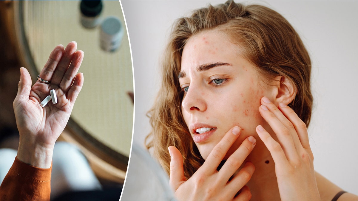 Person taking vitamins and a woman popping a pimple