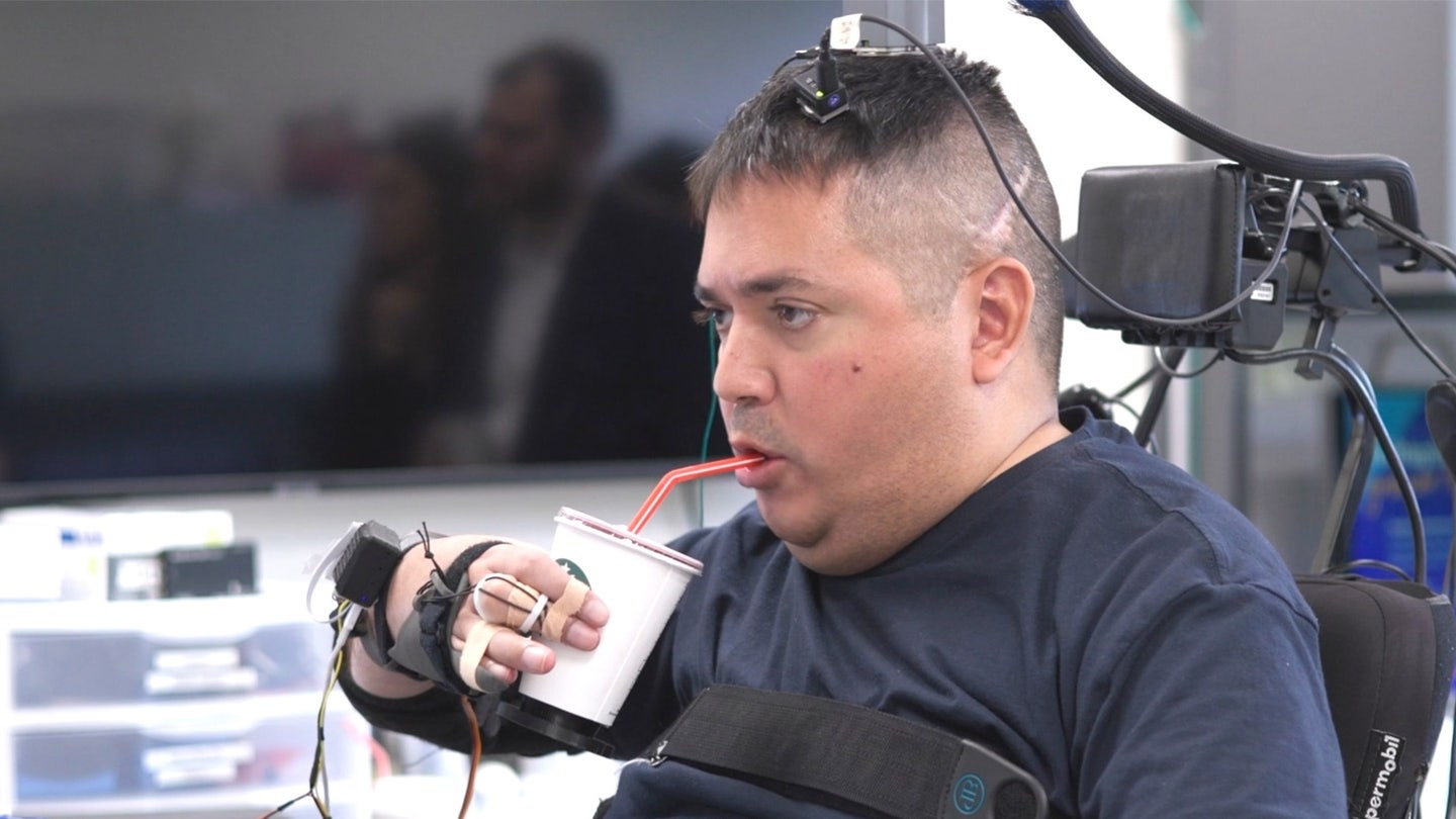 Paralyzed Man Regains Movement and Sensation with AI Brain Implant