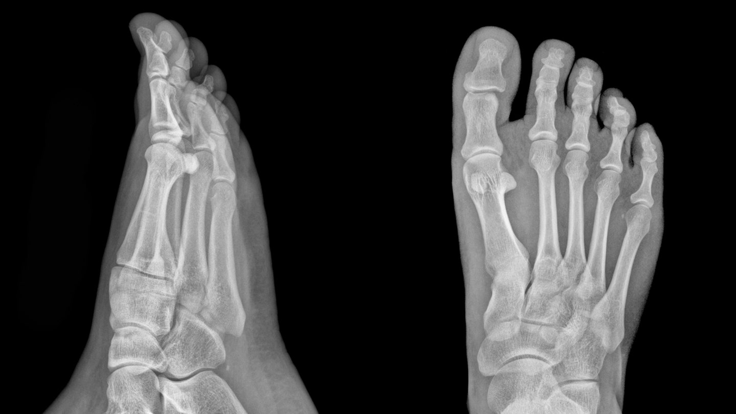 BIZARRE WASHINGTON LAWS: From Shoe-Fitting X-Rays to Sasquatch Protection