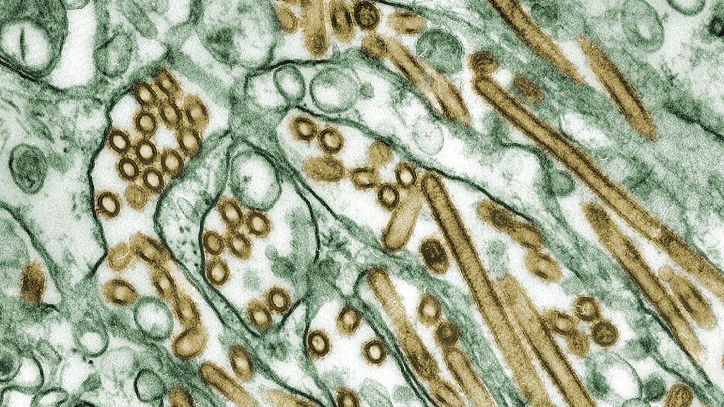 Bird Flu Confirmed in Human in Los Angeles County, First Severe Case in Louisiana