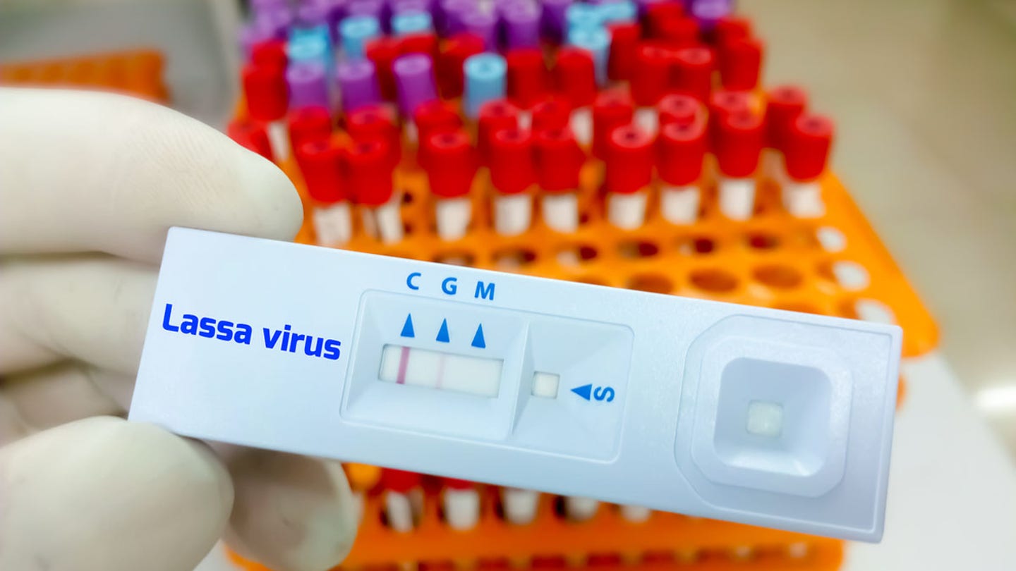 lassa virus