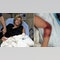 Florida teen surfer attacked by shark, says it ‘could have been so much worse’