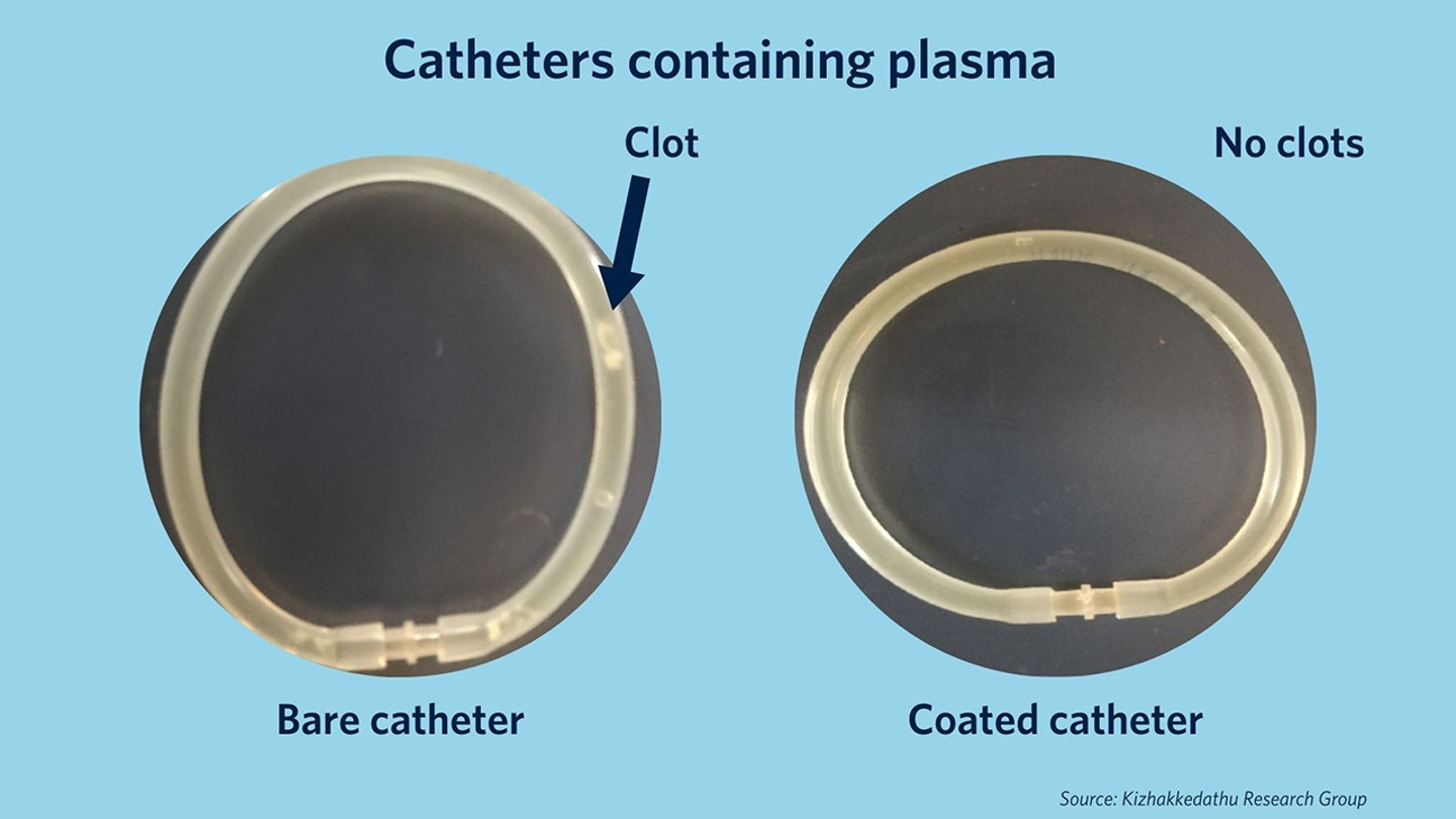 catheters containing plasma