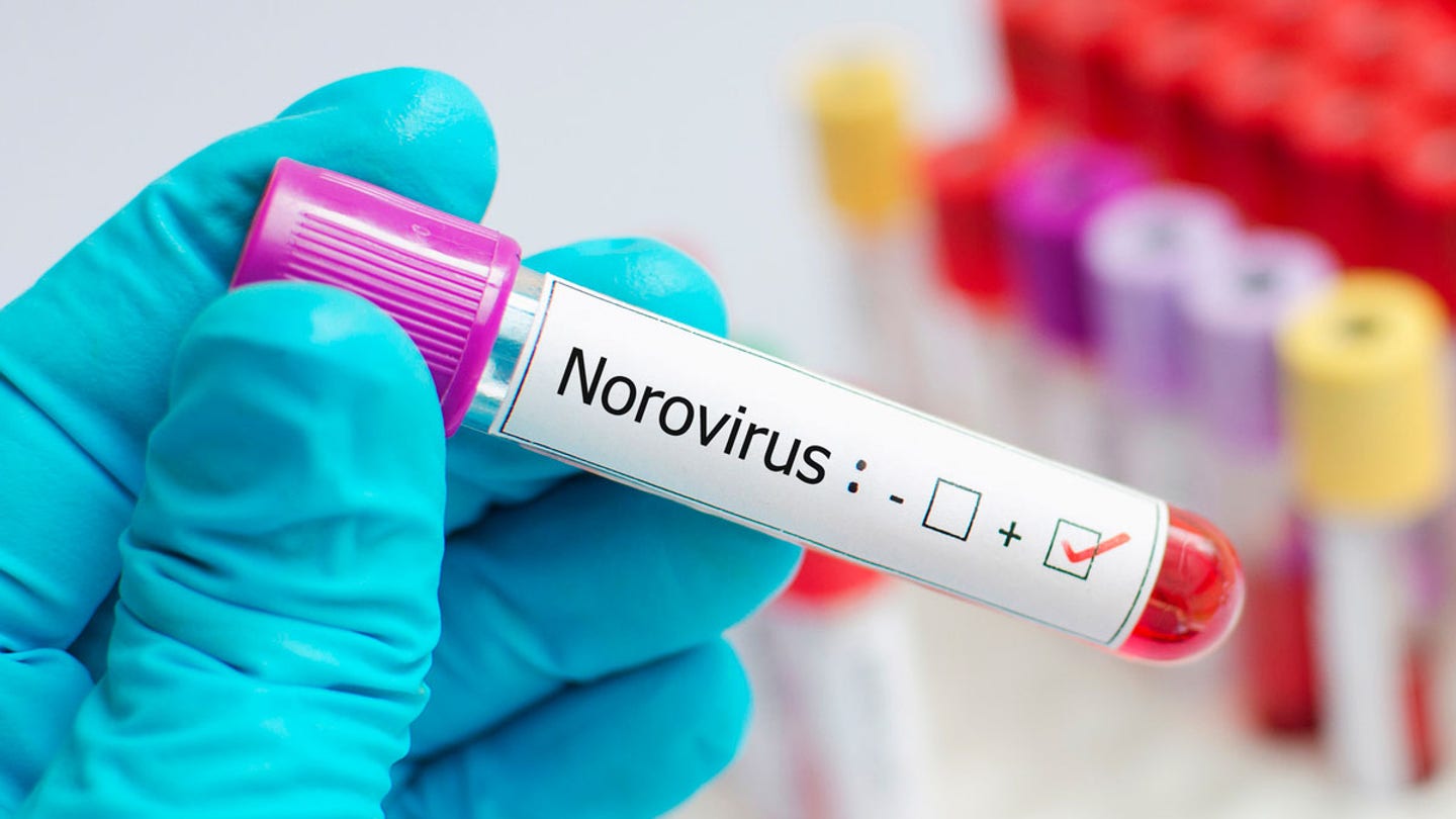 norovirus test