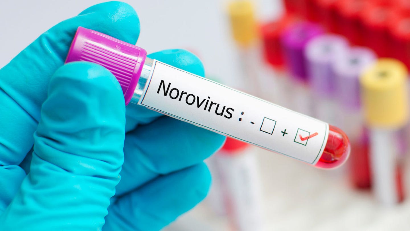 norovirus test