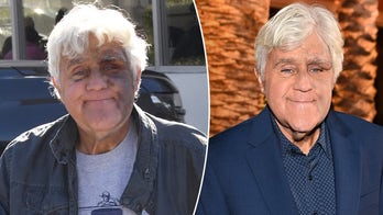 Jay Leno ‘feeling good’ despite suffering bruised face from fall