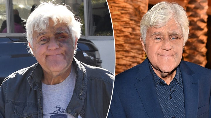 Jay Leno says he’s ‘very lucky in life’ as he cares for his wife with dementia