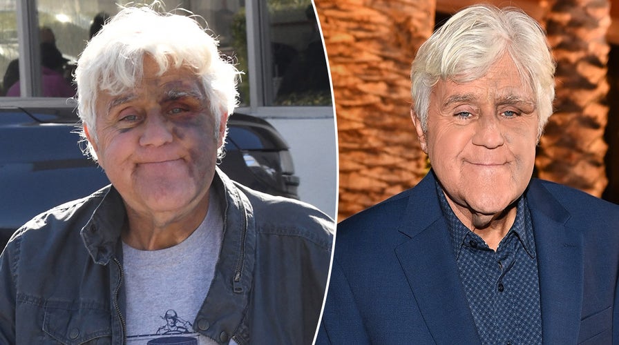 Jay Leno says he’s ‘very lucky in life’ as he cares for his wife with dementia