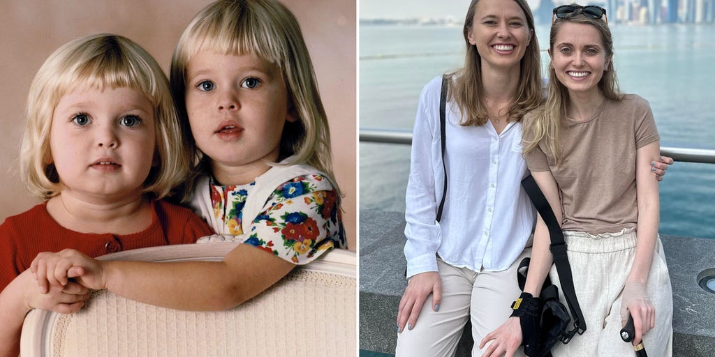 Rare disease diagnosis strengthens bond between twin sisters: 'Doing our best'