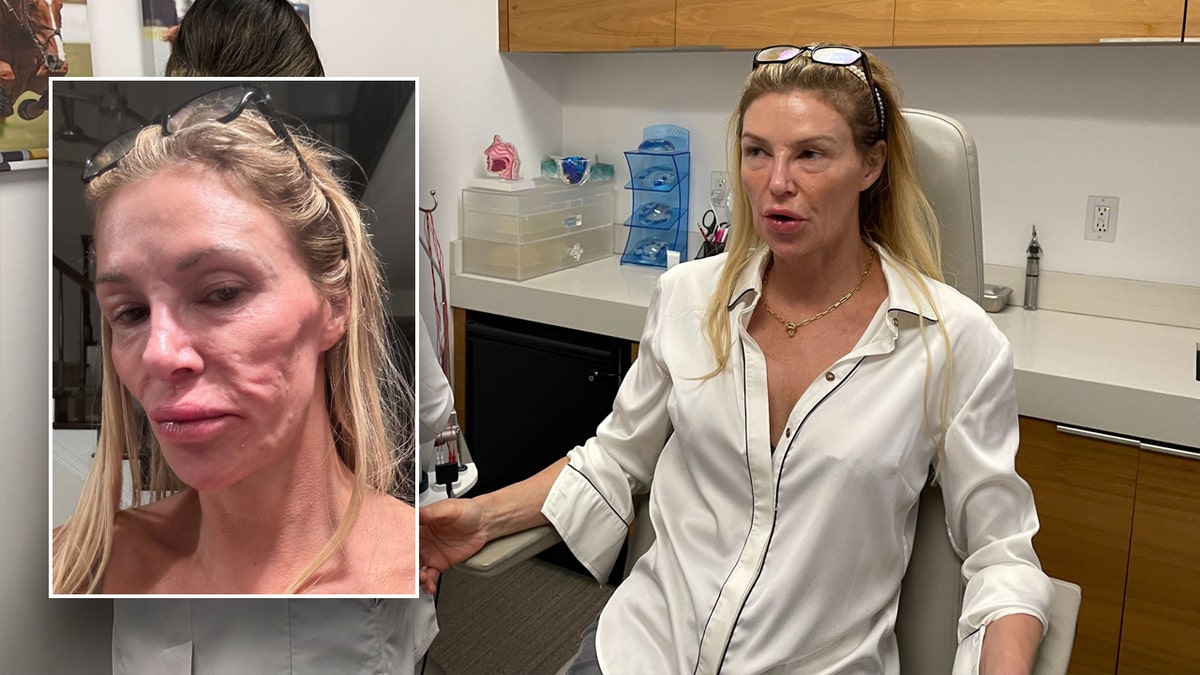 Brandi Glanville in a doctor's office with an inset of her facial disfigurement