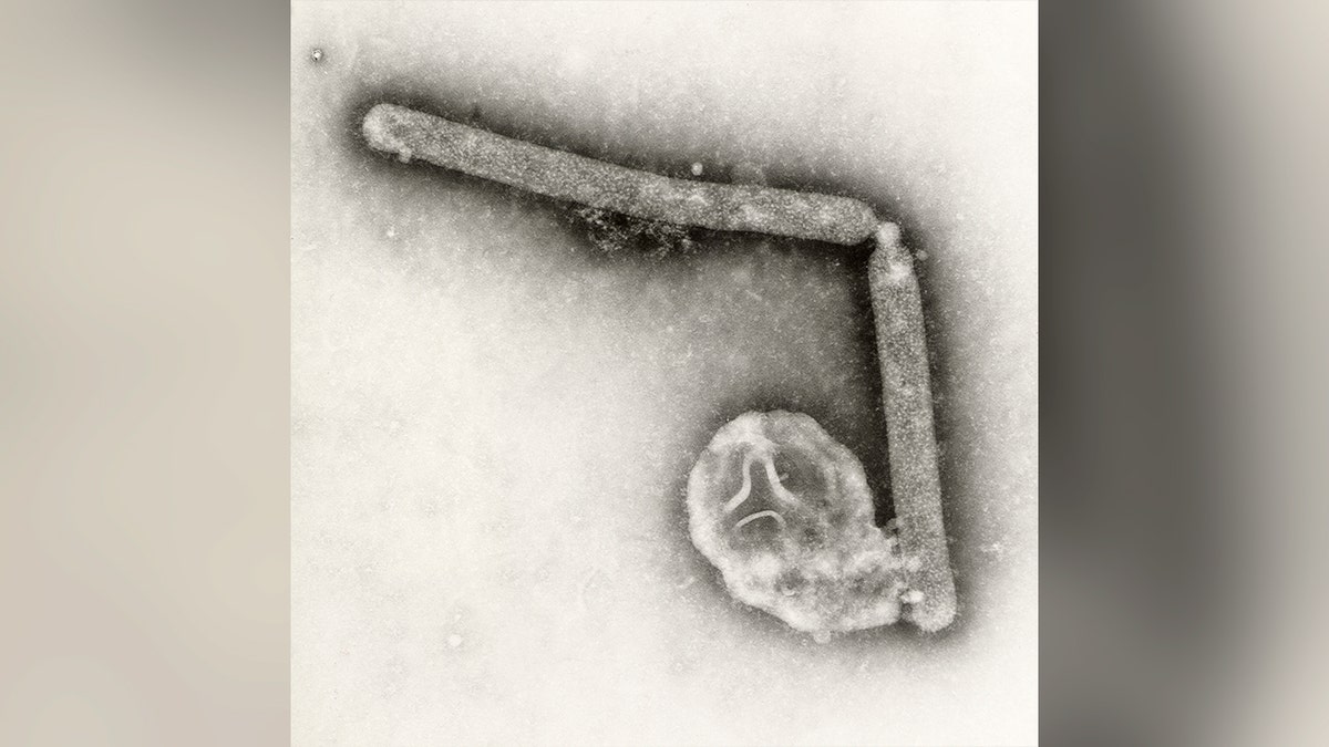 Bird flu microscopic