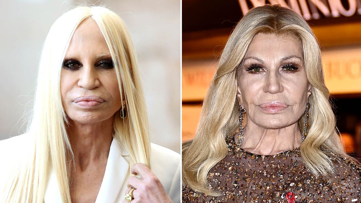 Donatella Versace 2014 and 2024 side by side