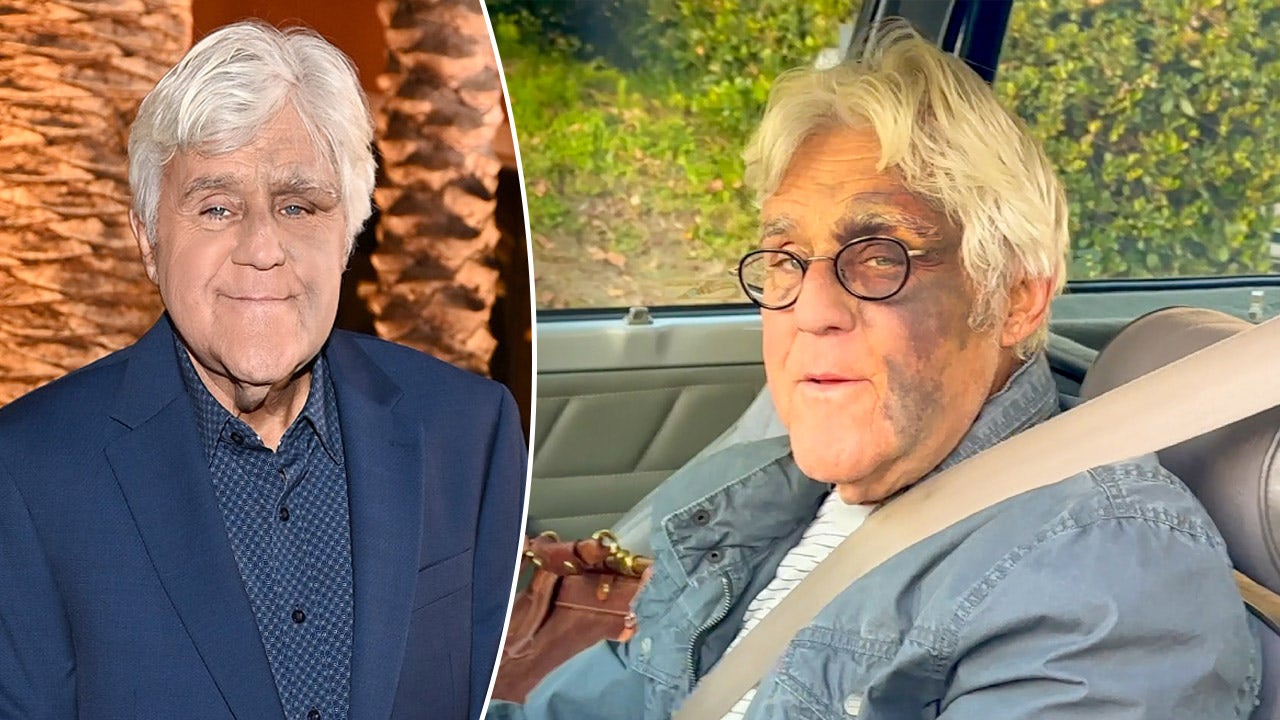 Jay Leno puts mob beating rumors to rest regarding facial bruises | Fox News
