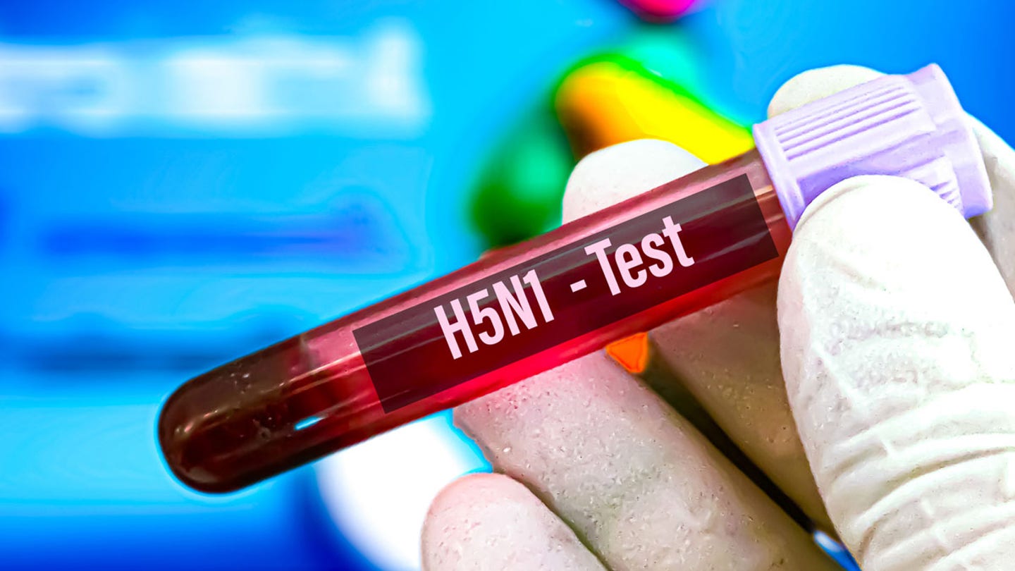 h5n1 test 1