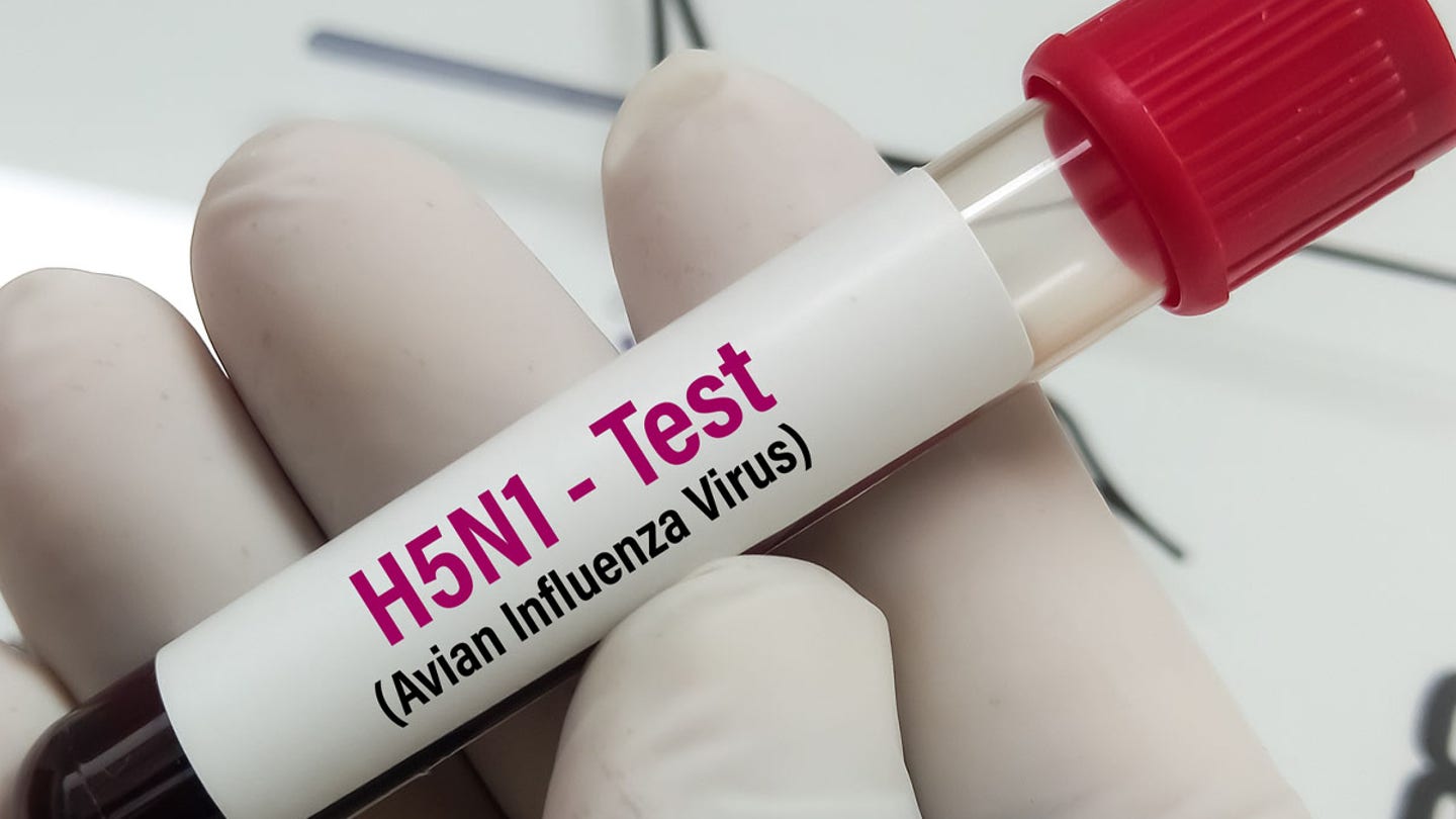 h5n1 test