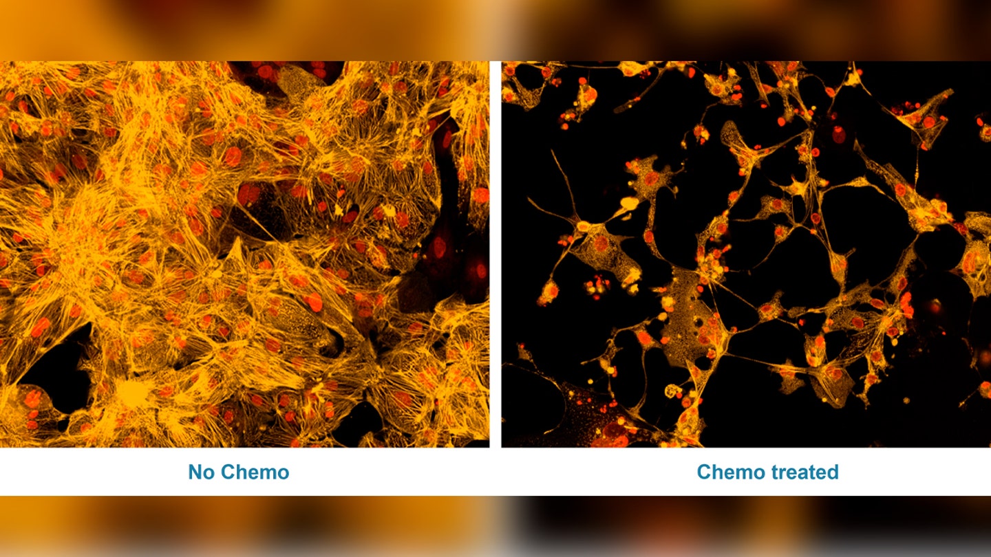 heart cells treated with and without chemo