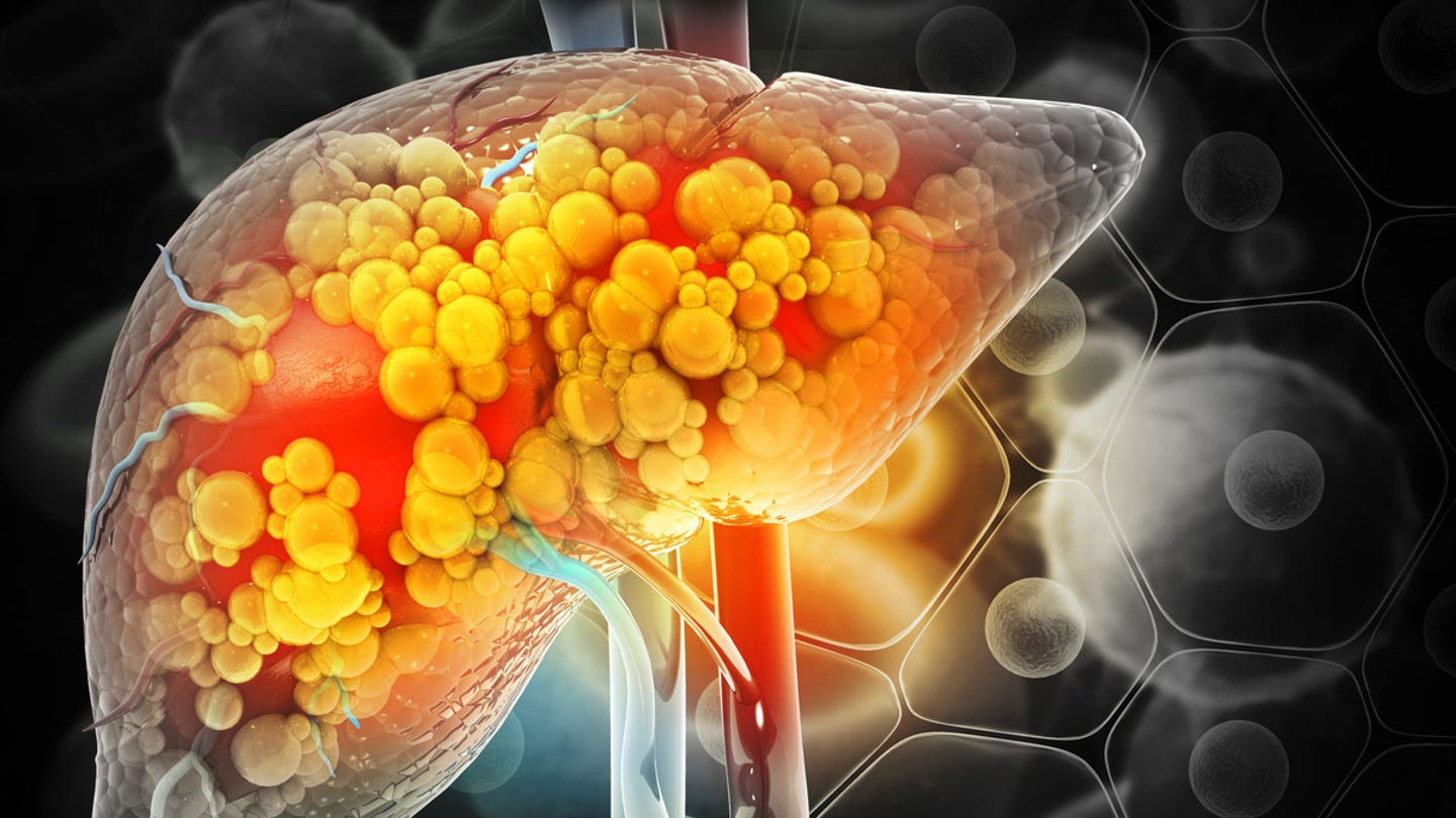 liver damage