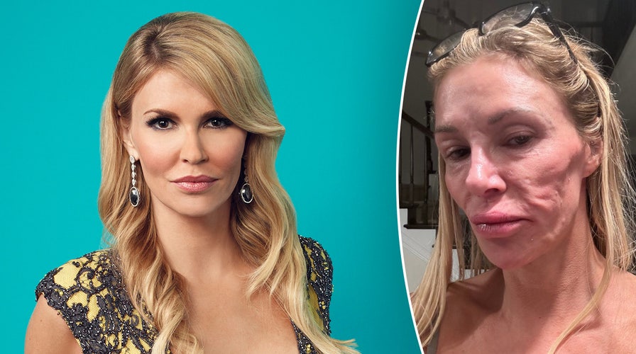 Brandi Glanville shares stripped down photo as she claims her 'looks are  ruined' by mystery illness | Fox News
